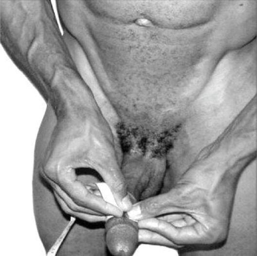 измерване на пениса преди уголемяване